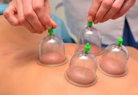 Hijama Center Abbottabad | Hijama/Cupping Services Hijama Center Abbottabad | Hijama/Cupping Services
