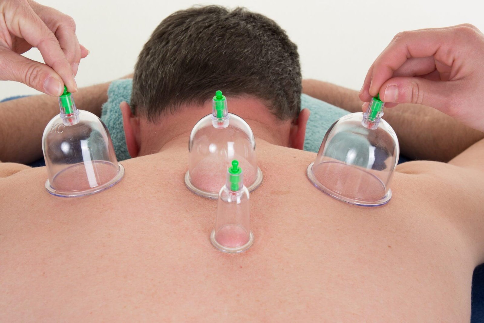 Hijama Center Abbottabad | Hijama/Cupping Services Hijama Center Abbottabad | Hijama/Cupping Services